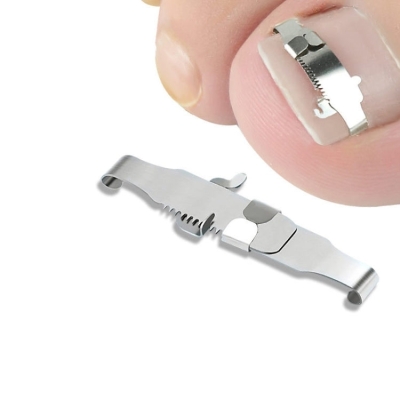 Orthopedic Buckle Toe Nail Groove Ingrown Nail Corrector, Style:No. 44, Specifications:Positive Nail Buckle